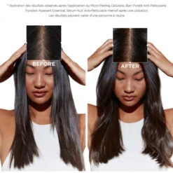 Bain Pureté Anti-pelliculaire Symbiose Kérastase 500ML 11 Bain Pureté Anti-pelliculaire Symbiose Kérastase 500ML -Beauty Care Soldes bain purete anti pelliculaire symbiose kerastase 500ml 2