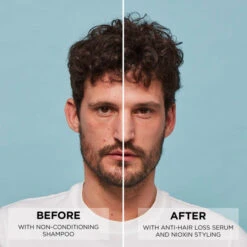 Sérum Anti-chute Sandalore™ Nioxin 70ML -Beauty Care Soldes serum anti chute sandalore nioxin 70ml 2