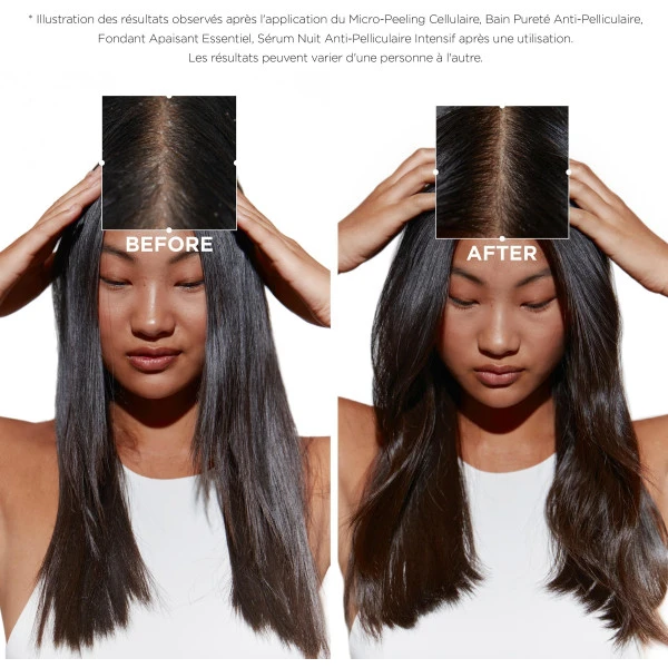 Sérum Cellulaire Nuit Anti-pelliculaire Intensif Symbiose Kérastase 90ML 6 Sérum Cellulaire Nuit Anti-pelliculaire Intensif Symbiose Kérastase 90ML - Image 4