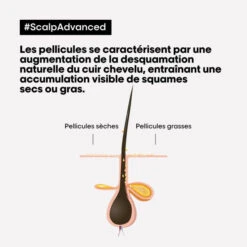 Shampooing Clarifiant Antipelliculaire Scalp Advanced L'Oréal Professionnel 1,5L 11 Shampooing Clarifiant Antipelliculaire Scalp Advanced L'Oréal Professionnel 1,5L -Beauty Care Soldes shampooing clarifiant antipelliculaire scalp advanced l oreal professionnel 15l 3