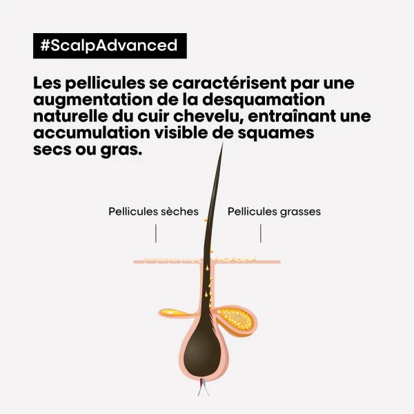 Shampooing Clarifiant Antipelliculaire Scalp Advanced L'Oréal Professionnel 1,5L 6 Shampooing Clarifiant Antipelliculaire Scalp Advanced L'Oréal Professionnel 1,5L - Image 4