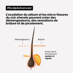 Traitement Apaisant Intense Scalp Advanced L'Oréal Professionnel 200ML -Beauty Care Soldes traitement apaisant intense scalp advanced l oreal professionnel 200ml 5